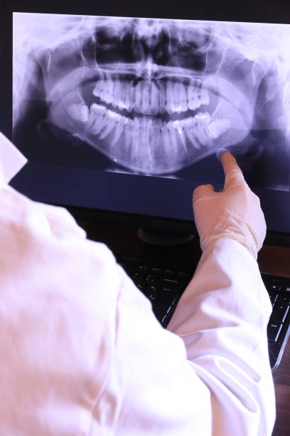 Best Emergency Wisdom Tooth Extraction in Nashua, NH