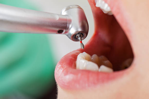 Best Emergency Pediatric Dental Care in Nashua, NH